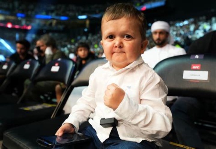 The Mystery Of Hasbulla's Rare Medical Condition