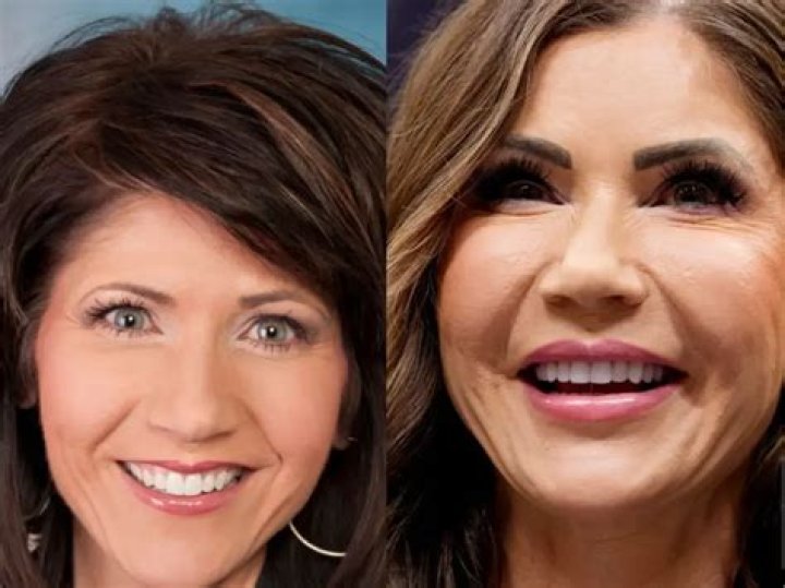 Transformative Journey: Kristi Noem Before And After