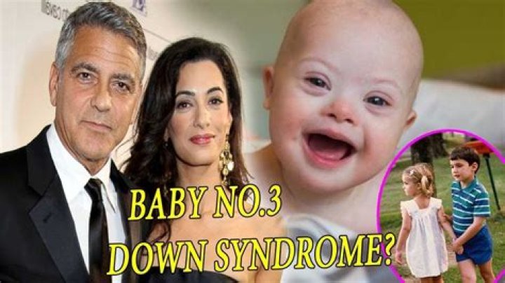 Understanding George Clooney's Life: The Twins And Down Syndrome Journey