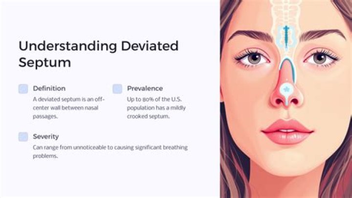 Understanding Owen Wilson's Deviated Septum And Unique Nose