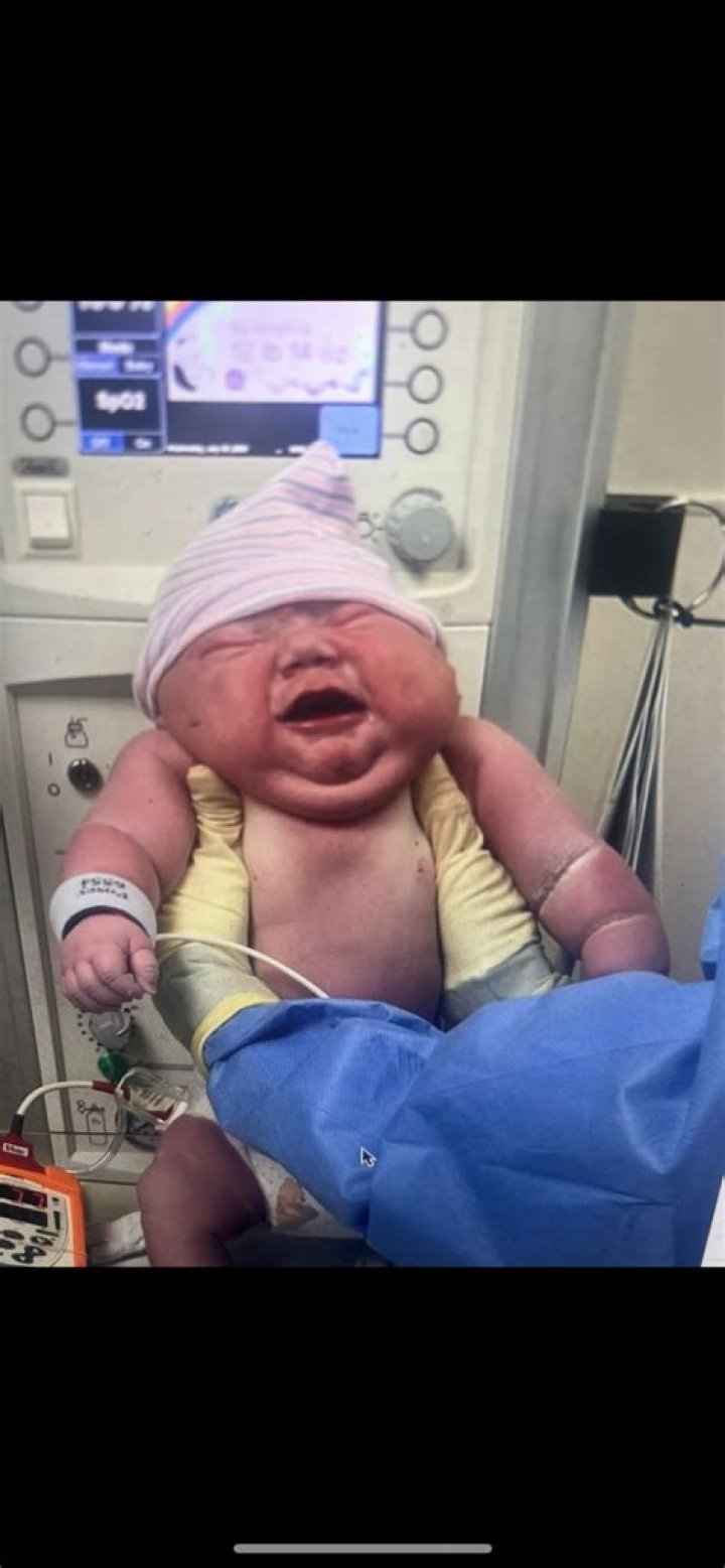 Unraveling The Mystery: What Is The Most Amount Of Babies Born At Once?