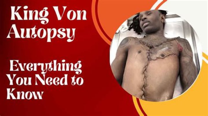 Unraveling The Tragedy: King Von's Gunshot Wound And Its Aftermath