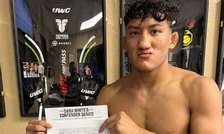 Unveiling The Secrets Behind Raul Rosas Jr's Teeth